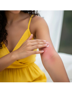 CERAPY BETA RELIEF CREMA LENITIVA - LINEA BETA 50 ML