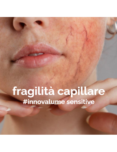 INNOVALUME SENSITIVE CREMA VISO - COUPEROSE ROSACEA E FRAGILITÀ CAPILLARE 50 ML
