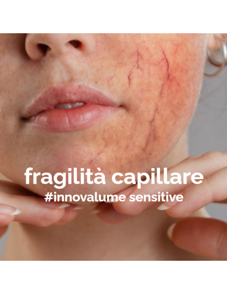 INNOVALUME SENSITIVE CREMA VISO - COUPEROSE ROSACEA E FRAGILITÀ CAPILLARE 50 ML